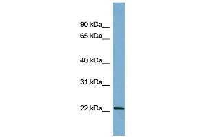 BTG4 antibody used at 1 ug/ml to detect target protein. (BTG4 Antikörper  (Middle Region))