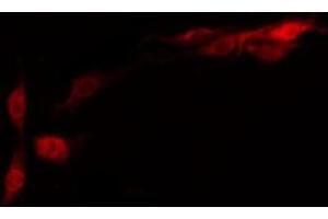 anti-Opsin 5 (OPN5) (Internal Region) antibody