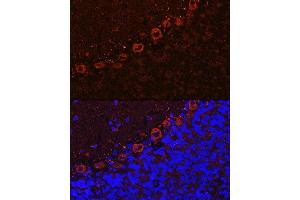 Immunofluorescence (IF) image for anti-Amyotrophic Lateral Sclerosis 2 (Juvenile) (ALS2) (AA 1-280) antibody (ABIN6136830)