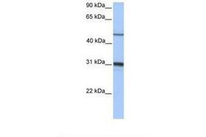 Image no. 1 for anti-Epoxide Hydrolase 1, Microsomal (Xenobiotic) (EPHX1) (AA 182-231) antibody (ABIN6738923) (EPHX1 Antikörper  (AA 182-231))