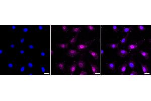 Immunocytochemical staining of C2C12 cells with Phospho-AKT1 (S124) antibody (ABIN7800784), 1:1,000).