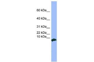 VIP antibody used at 1 ug/ml to detect target protein. (Vip Antikörper  (Middle Region))