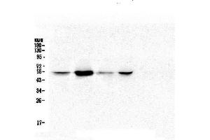 Western blot analysis of RbAp48 using anti-RbAp48 antibody (ABIN5692929).