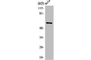 Western Blot analysis of COLO205 cells using PLK-5 Polyclonal Antibody (PLK5 Antikörper  (Internal Region))