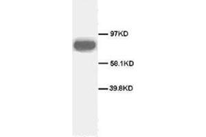 Western blot analysis of rat spleen sections using CD71 antibody (Transferrin Receptor Antikörper  (C-Term))