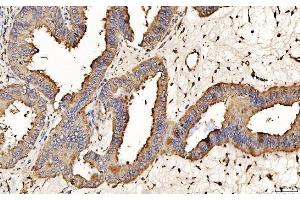 IHC analysis of PDIA6 using anti-PDIA6 antibody (ABIN7600554). (PDIA6 Antikörper  (AA 20-440))