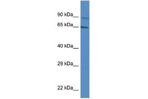 WB Suggested Anti-MUS81 AntibodyTitration: 1. (MUS81 Antikörper  (Middle Region))