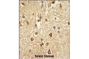 Formalin-fixed and paraffin-embedded human brain tissue reacted with DLX2 Antibody (Center), which was peroxidase-conjugated to the secondary antibody, followed by DAB staining. (DLX2 Antikörper  (AA 194-222))