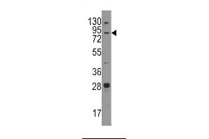 Western blot analysis of anti-Junctophilin 3 Pab (ABIN389172 and ABIN2839337) in mouse brain tissue lysates (35 μg/lane). (Junctophilin 3 Antikörper  (AA 549-578))