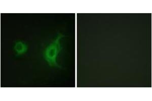 Immunofluorescence (IF) image for anti-Kinesin Family Member 20A (KIF20A) (AA 501-550) antibody (ABIN2888893) (KIF20A Antikörper  (AA 501-550))