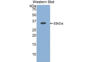 Detection of Recombinant ITGb3, Mouse using Polyclonal Antibody to Integrin Beta 3 (ITGb3) (Integrin beta 3 Antikörper  (AA 134-376))