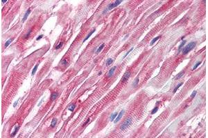 Human Heart (formalin-fixed, paraffin-embedded) stained with Tubulin, Alpha 1 (TUBA1) antibody ABIN239814 at 5 ug/ml followed by biotinylated anti-mouse IgG secondary antibody ABIN481714, alkaline phosphatase-streptavidin and chromogen.
