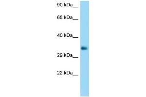 WB Suggested Anti-FCGR2B Antibody Titration: 1. (FCGR2B Antikörper  (C-Term))
