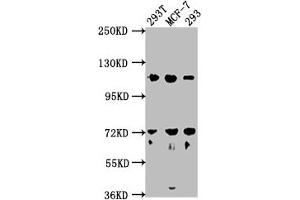 Western Blot Positive WB detected in: 293T whole cell lysate, MCF-7 whole cell lysate, 293 whole cell lysate All lanes: WDR59 antibody at 1:2000 Secondary Goat polyclonal to rabbit IgG at 1/50000 dilution Predicted band size: 110, 65, 63, 47 kDa Observed band size: 110 kDa