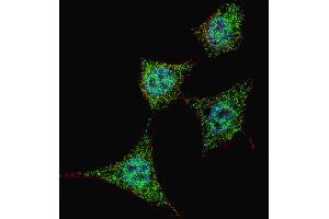 Fluorescent confocal image of HeLa cells stained with phospho-Bad-S99 antibody. (BAD Antikörper  (pSer99))