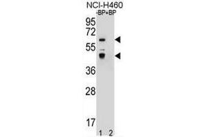 Western blot analysis of PRAMEF3 Antibody (C-term) Pab pre-incubated without(lane 1) and with(lane 2) blocking peptide in NCI-H460 cell line lysate. (PRAMEF3 Antikörper  (C-Term))