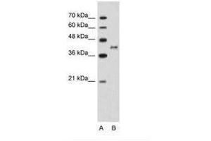 Image no. 1 for anti-Bradykinin Receptor B2 (BDKRB2) (N-Term) antibody (ABIN203497) (BDKRB2 Antikörper  (N-Term))