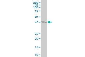 anti-Caudal Type Homeobox 4 (CDX4) (AA 202-284) antibody