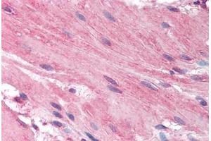 Human Small Intestine, Smooth Muscle (formalin-fixed, paraffin-embedded) stained with HRH1 antibody ABIN297157 at 2. (HRH1 Antikörper  (AA 471-484))