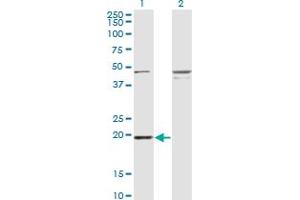 Western Blot analysis of RBBP9 expression in transfected 293T cell line by RBBP9 monoclonal antibody (M03A), clone 3H4. (RBBP9 Antikörper  (AA 1-186))