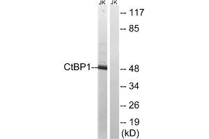 Western blot analysis of extracts from Jurkat cells, using CtBP1 (epitope around residue 422) antibody. (CTBP1 Antikörper  (Ser422))