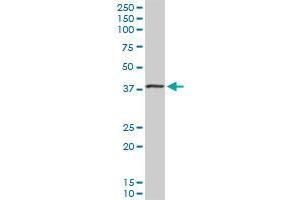 Western Blotting (WB) image for anti-Eukaryotic Translation Initiation Factor 2B, Subunit 2 Beta, 39kDa (EIF2B2) (AA 1-351) antibody (ABIN522378)