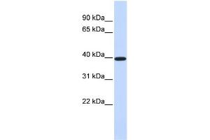 Western Blotting (WB) image for anti-X-Ray Repair Complementing Defective Repair in Chinese Hamster Cells 4 (XRCC4) (Middle Region) antibody (ABIN2778273)