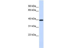WB Suggested Anti-XRCC4 Antibody Titration:  0. (XRCC4 Antikörper  (Middle Region))