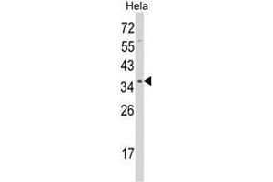 Western blot analysis of STRAP Antibody (C-term) in Hela cell line lysates (35ug/lane). (STRAP Antikörper  (C-Term))
