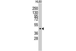 Western blot analysis of Lmx1a polyclonal antibody  in HL-60 cell line lysates (35 ug/lane). (LMX1A Antikörper  (Internal Region))