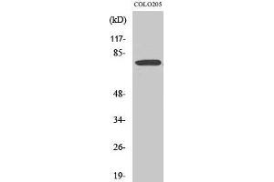 Western Blot (WB) analysis of COLO205 cells using EWS Polyclonal Antibody. (EWSR1 Antikörper  (Internal Region))