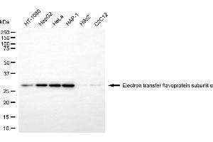 Western blotting analysis using electron transfer flavoprotein subunit alpha antibody (ABIN7798431).