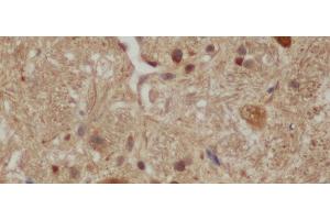 Immunohistochemistry of paraffin-embedded Mouse brain using Aβ40 Polyclonal Antibody at dilution of 1:50 (Abeta 1-40 Antikörper)