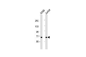 All lanes : Anti-F11 Antibody (Center) at 1:1000 dilution Lane 1: A549 whole cell lysate Lane 2: Jurkat whole cell lysate Lysates/proteins at 20 μg per lane. (Factor XI Antikörper  (AA 281-307))