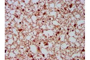 Immunohistochemistry (IHC) image for anti-HECT, C2 and WW Domain Containing E3 Ubiquitin Protein Ligase 2 (HECW2) (AA 495-641) antibody (ABIN7151037)