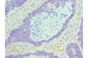 Immunohistochemistry of paraffin-embedded human ovarian cancer using ABIN7160088 at dilution of 1:100 (MAD2L1 Antikörper  (AA 1-205))