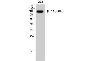 Western Blotting (WB) image for anti-PR (pSer400) antibody (ABIN3182420) (PR (pSer400) Antikörper)