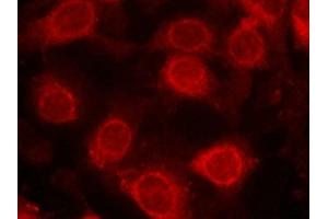 Immunofluorescence staining of methanol-fixed MCF cells using eIF4E(Phospho-Ser209) Antibody. (EIF4E Antikörper  (pSer209))