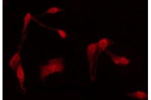 Immunofluorescence (fixed cells) (IF/ICC) image for anti-DNA-Damage-Inducible Transcript 3 (DDIT3) (N-Term) antibody (ABIN6261867)