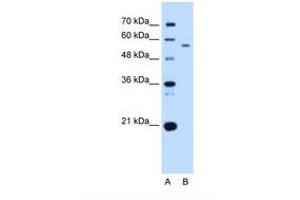 Image no. 2 for anti-UBX Domain Protein 4 (UBXN4) (AA 301-350) antibody (ABIN321312) (UBXD2 Antikörper  (AA 301-350))