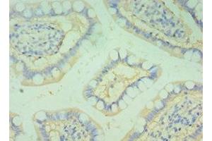 Immunohistochemistry of paraffin-embedded human small intestine tissue using ABIN7145826 at dilution of 1:100 (BOC Antikörper  (AA 1-125))