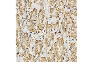 Immunohistochemistry of paraffin-embedded human stomach using PRDX4 antibody at dilution of 1:200 (x400 lens) (Peroxiredoxin 4 Antikörper)
