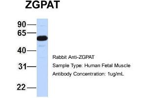 Host: Rabbit Target Name: ZGPAT Sample Type: Human Fetal Muscle Antibody Dilution: 1.
