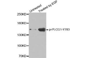 Western Blotting (WB) image for anti-phospholipase C, gamma 1 (PLCG1) (pTyr783) antibody (ABIN1870508) (Phospholipase C gamma 1 Antikörper  (pTyr783))