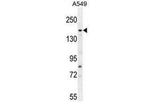 FGD6 Antibody (C-term) western blot analysis in A549 cell line lysates (35µg/lane). (FGD6 Antikörper  (C-Term))
