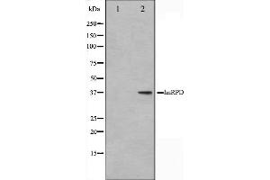 Western blot analysis on HuvEc cell lysate using hnRPD Antibody. (HNRNPD/AUF1 Antikörper  (Internal Region))