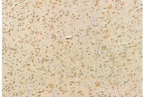 ABIN6260789 and ABIN6272910 at 1/100 staining Rat brain tissue by IHC-P. (CHCHD2 Antikörper  (Internal Region))