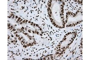 Image no. 8 for anti-Aryl Hydrocarbon Receptor Nuclear Translocator (ARNT) antibody (ABIN1496729) (ARNT Antikörper)