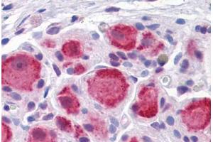 Human Ganglion cells: Formalin-Fixed, Paraffin-Embedded (FFPE) (DARS Antikörper  (AA 393-501))