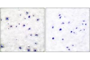 Immunohistochemistry analysis of paraffin-embedded human brain tissue, using Trk A (Ab-791) Antibody. (TRKA Antikörper  (AA 747-796))